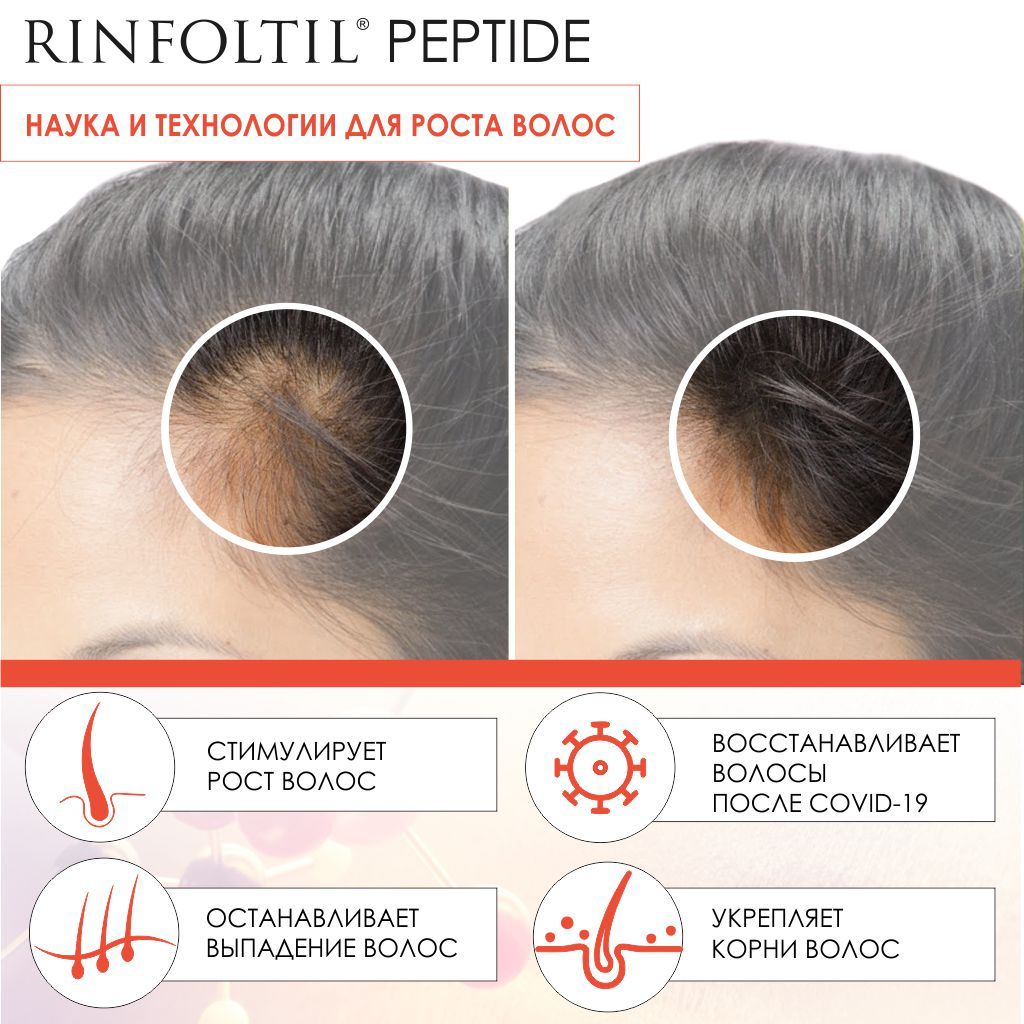 Rinfoltil Peptide Липосомальная сыворотка против выпадения волос, липосомальная сыворотка, 30 шт.